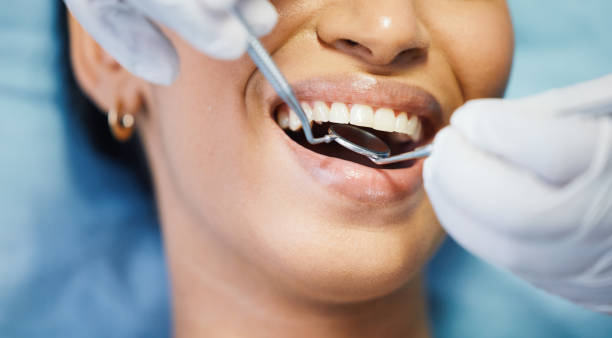 Best Emergency Root Canal Treatment in Vardaman, MS