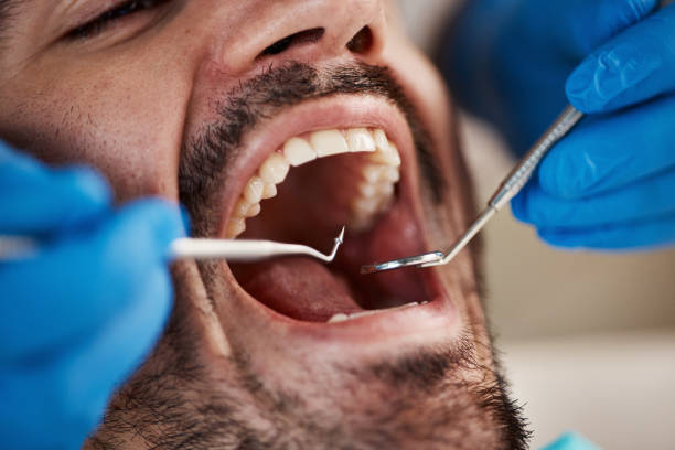 Best Emergency Dental Care for Broken or Chipped Teeth in Vardaman, MS